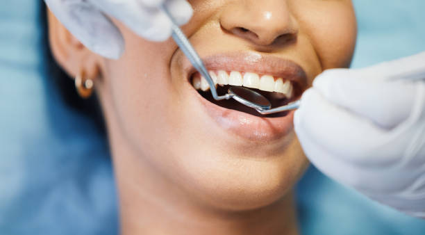 Best Emergency Dentist for Knocked-Out Tooth in Cannelton, IN
