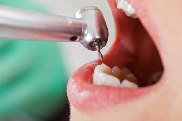 Best Emergency Dental Services for Seniors in Cannelton, IN
